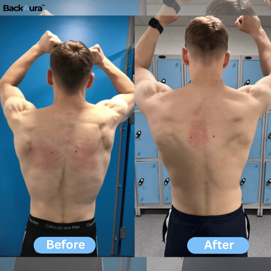 Back Aura™ Instant Posture Corrector
